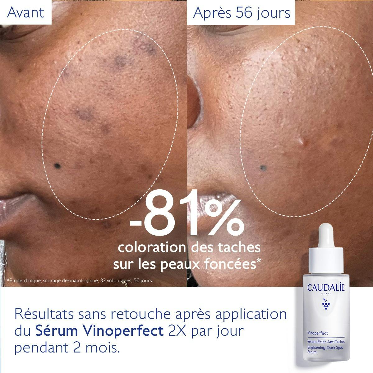 Sérum Éclat Anti-Taches à la Viniférine, alternative à la Vitamine C - 30ml